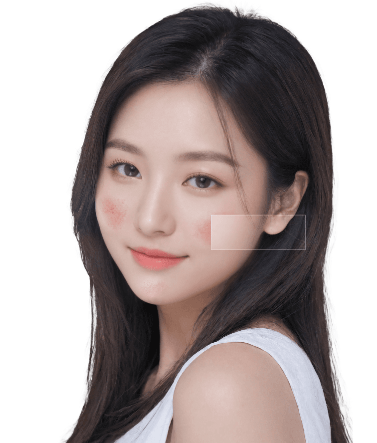 부천 안면홍조 폐경기 홍조치료, 갑자기 달아오르기 시작했다면